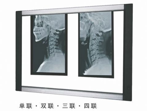 點擊查看詳細信息<br>標題：LED觀片燈 閱讀次數(shù)：2534